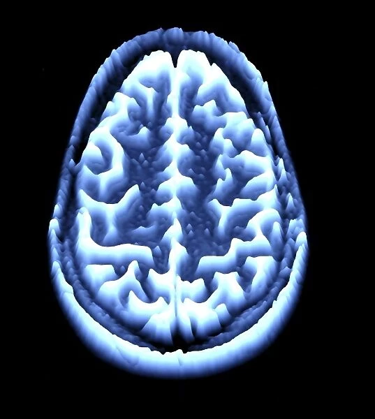 Brain scan, MRI scan, heightmap F006  /  7093