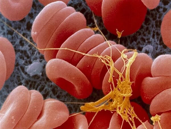 Coloured SEM of an early blood clot forming