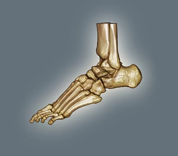 Normal foot, 3D CT scan