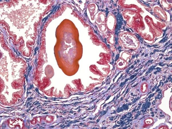 Prostate, light micrograph