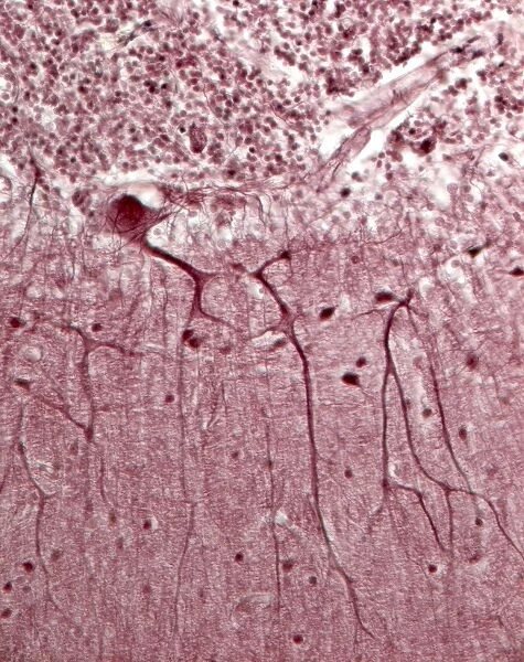 Purkinje neurons, light micrograph