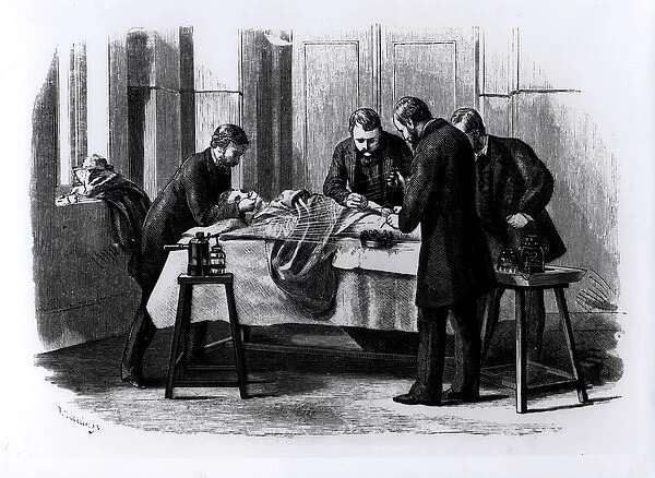 Antiseptic Surgery, 1882 (engraving) (b  /  w photo)