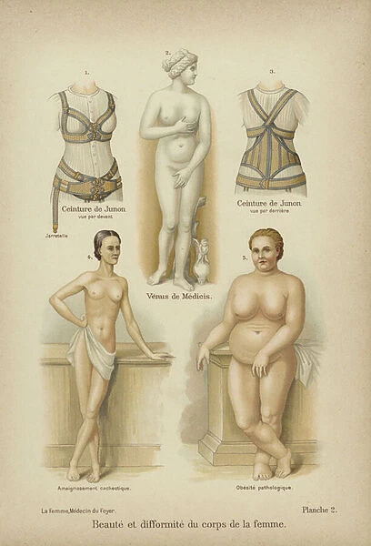 Beauty and misshapennes in the female body (colour litho)