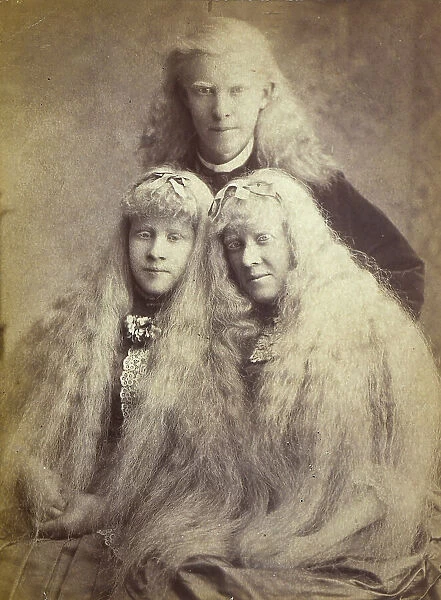 Portrait of three albinos, two sisters and their brother