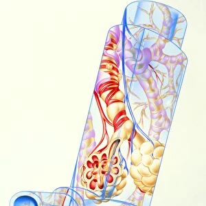 Artwork of asthmatic respiratory system on inhaler