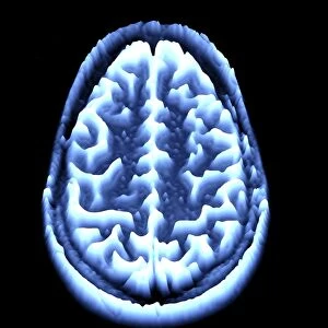 Brain scan, MRI scan, heightmap F006 / 7093