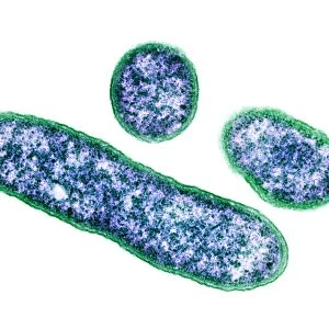 Erwinia bacteria, TEM