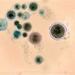 Hartmannella vermiformis protozoa cysts C016 / 9402