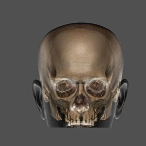 Human skull, 3D CT scan F006 / 9105