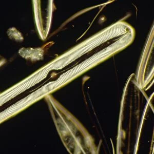 LM of the diatom Pinnularia nobilis
