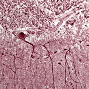 Purkinje neurons, light micrograph
