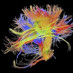White matter fibres of the human brain C014 / 5670