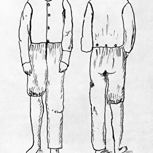 WOMENs UNDERGARMENT, 1878. Reform Undersuit. Front and rear view of a new style of womens undergarment as an alternative to petticoats, designed by Mary Edwards Walker. Wood engraving, 1878