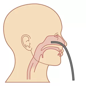 Cross section biomedical illustration of endoscope inserted through nose for Anterior Rhinoscopy procedure