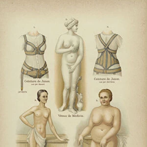 Beauty and misshapennes in the female body (colour litho)