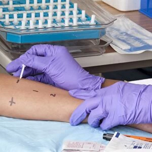 A person receiving a skin prick allergy test