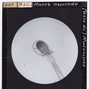 Mucor Mucedo ascus (Mucorinea) enlarged under a microscope