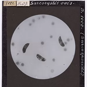 Sarcocystis bovis (Sarcosporidia) enlarged under a microscope