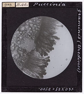 Phragmidium asperum fungus, belonging to the Uredineae, enlarged under a microscope
